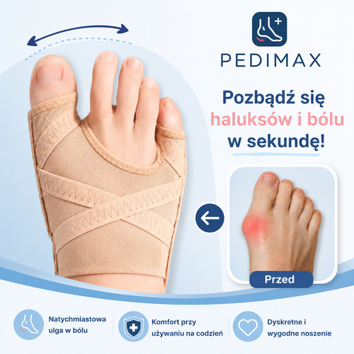 PediMax™ - Korektor Haluxów
